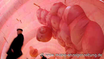 Darmkrebs vorbeugen: Auf welche Anzeichen Sie unbedingt achten sollten