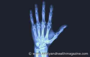 FMCSA clarifies 'medical treatment' for accident register determination - Safety+Health magazine