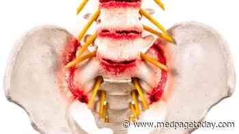 Ankylosing Spondylitis: Another Step Toward Individualized Therapy