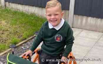 Rossendale: Plea for support as brain damaged boy set for more surgery