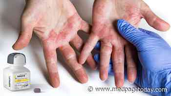 Extension Study Confirms JAK Inhibitor's Activity in Atopic Dermatitis