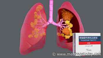 Another China-Developed PD-1 Inhibitor Makes Its Case in NSCLC