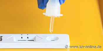 Corona-Tests für 40 Millionen Euro