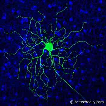 FDA-Approved Drug May Help Revive Vision in People With Progressive Blinding Disorders