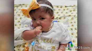 Cincinnati Children's doctors perform life-saving surgery on baby with Trisomy 18 - FOX19