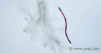 'Magnetic Tentacle Robot' Could Slink Around Inside Patients' Lungs     - CNET