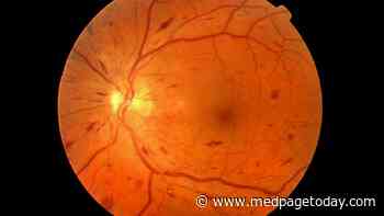 Diabetic Eye Disease Linked With Neurodegenerative Disorders