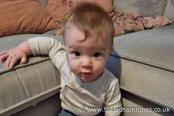 Mum's desperation for less painful treatment to baby's club foot - The Oldham Times