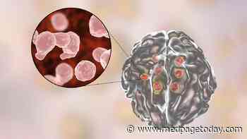 Simpler Antifungal Course Works for Cryptococcal Meningitis in Africa