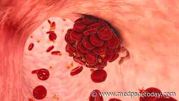 Blood Clots More Likely With COVID Versus Pneumonia