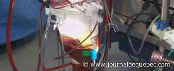 Le délestage a allongé les listes d'attente pour dons d'organes