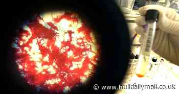 Covid pandemic could see rise in 'disease of yesteryear' says expert - Hull Live