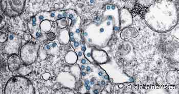 Alberta COVID-19 wastewater levels trending up in Calgary, Edmonton