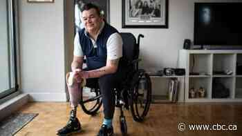 Tooth issues can cause life-threatening conditions, advocates say, as feds move on dental care