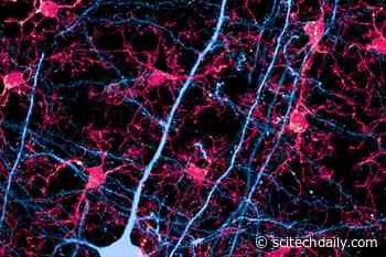 Long-Term Benzodiazepine (Xanax, Klonopin, Ativan) Use Destroys Neural Connections in the Brain