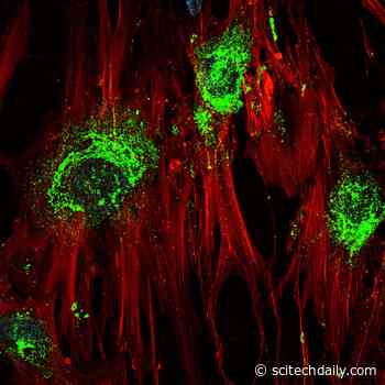Sonic Advance: How High-Frequency Sound Waves Could Help Regrow Bones