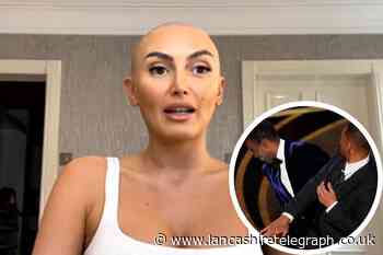 Ex on the Beach star Zara speaks on alopecia after Chris Rock and Will Smith slap