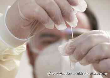 Juazeiro (BA) registra dois óbitos por Covid-19 em 24h - Blog Edenevaldo Alves