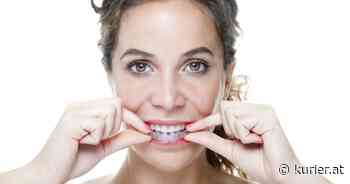 DrSmile und Co: Können Zahnschienen ohne Zahnarzt funktionieren? - KURIER