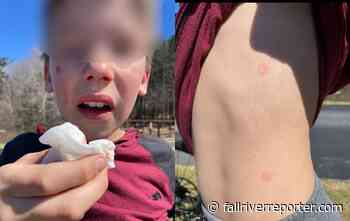 Fall River Police investigating after multiple incidents where people were struck with pellets - Fall River Reporter