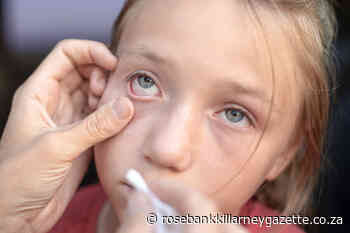 Help: My child has something stuck in their eye! - Rosebank Killarney Gazette