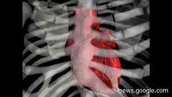 New heart failure guidelines add another type of meds to treatment recommendations - CNN