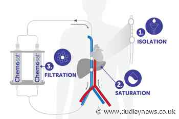 New liver cancer treatment 'effective in 90 of patients' - Dudley News