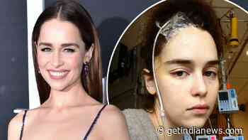 Does Emilia Clarke Have Aphasia? Stroke Horrors and Brain Surgery Details - Get India News