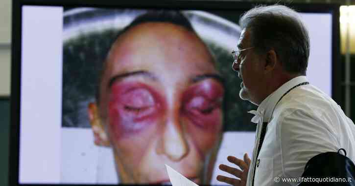 Stefano Cucchi, la Cassazione: “Fu omicidio preterintenzionale”. Definitiva la condanna per due carabinieri, per altri due nuovo appello