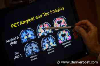 Aurora site part of effort to diversify Alzheimer’s drug trials — but there’s a long way to go - The Denver Post