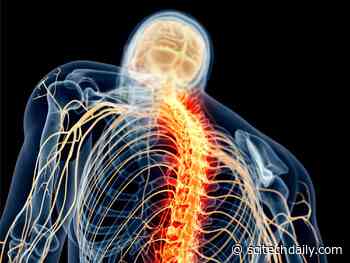 Scientists Uncover Why Long COVID Can Cause Pain – Could Lead to New Pain Medicine