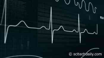Simple Electrocardiogram Can Identify Hospitalized COVID-19 Patients at Elevated Mortality Risk