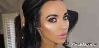 Atriz inglesa cai de escada após colocar silicone nos seios - UOL