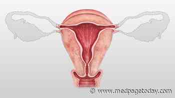 New Clue to Risk of Peritoneal Cancer After Prophylactic Salpingo-Oophorectomy