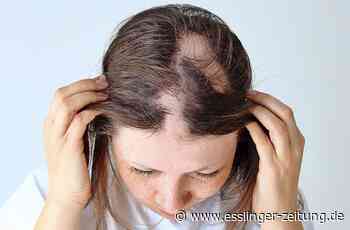 21-Jährige aus Reichenbach - Wie eine junge Frau mit kreisrundem Haarausfall umgeht - esslinger-zeitung.de