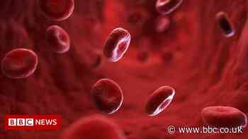 Basildon University Hospital: 70% of blood tests contaminated - BBC