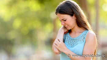 Psoriasi, una "malattia sociale": cos'è e come si cura