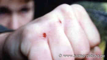 Raunheim: Jugendliche verletzen Mitschüler schwer – Passanten filmen mit - Fuldaer Zeitung