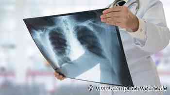 Digital Health: EU-Zulassung: KI darf Röntgenbilder analysieren - Computerwoche.de Live