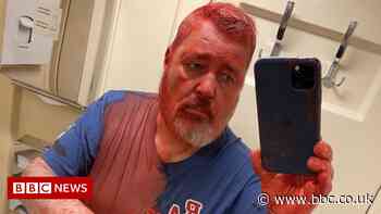 Ukraine war: Russia's Nobel winning editor Muratov doused with paint