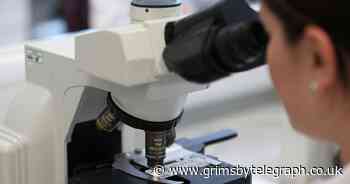 Researchers reverse ageing in human cells by 30 years – study - Grimsby Live