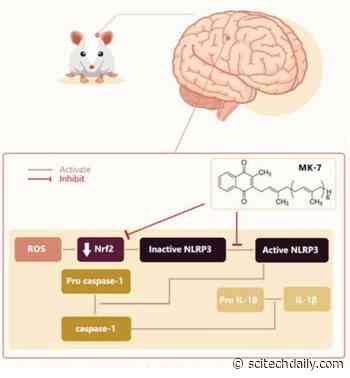 Evidence of Brain Benefits From Vitamin K – May Help Ward Off Dementia