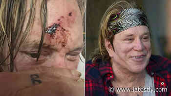 Agency News | ⚡Mickey Rourke Shares Gruesome Pictures of His Forehead Injury - LatestLY