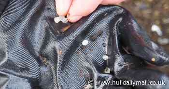 Hull scientists discover microplastics in deepest sections of human lungs in most concerning study yet - Hull Live