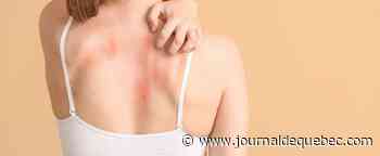 [BALADO] Pourquoi se gratter?