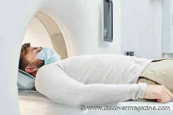 Can Strong Magnetic Pulses Cure Depression?