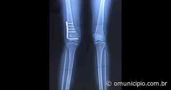 Jovem de Brusque que sofreu acidente realiza rifa para cirurgia de urgência no joelho - O Município