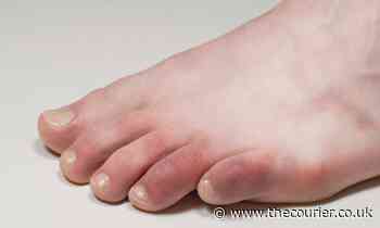 7 unusual side effects and symptoms of coronavirus - including Covid toe - The Courier