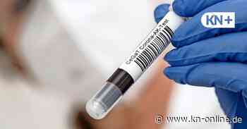 Corona-Impfschutz: Wie sinnvoll ist ein Antikörper-Test?