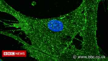 Rejuvenation of woman's skin could tackle diseases of ageing